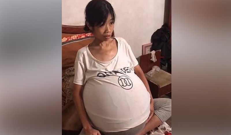 mysterious chinese woman whose belly ballooned uncontrollably from two years now begged for help kph