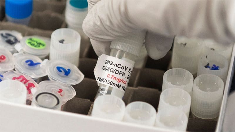 Covid 19 vaccine news And Updates World first covid 19 vaccine trial Completed russian health minister statement KPY