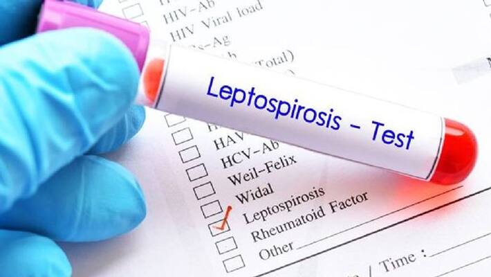 leptospirosis health worker died in kozhikode leptospirosis health worker died in kozhikode