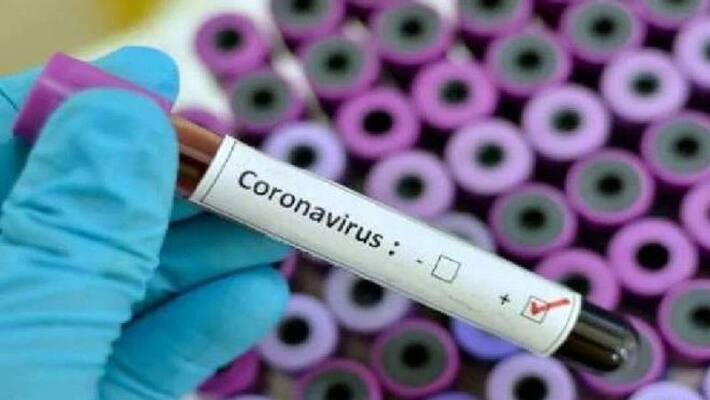 Coronavirus cases in Telangana cross 84 thousand Coronavirus cases in Telangana cross 84 thousand