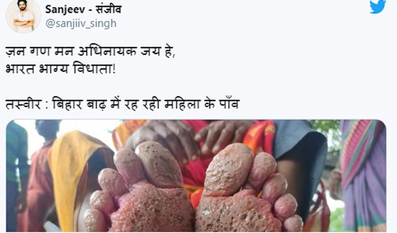 This womans foot got rotten in the flood water get viral from Bihar kph