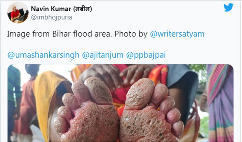 This womans foot got rotten in the flood water get viral from Bihar kph