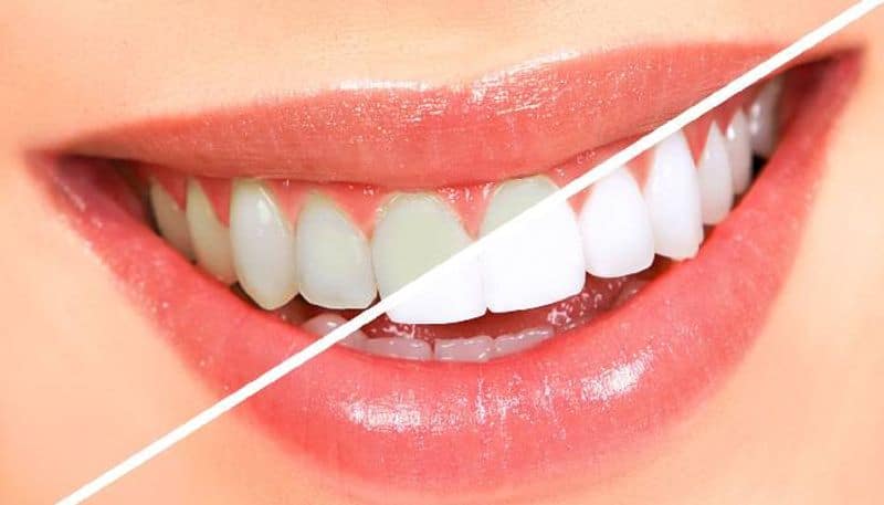 tips maintain a healthy mouth and strong teeth