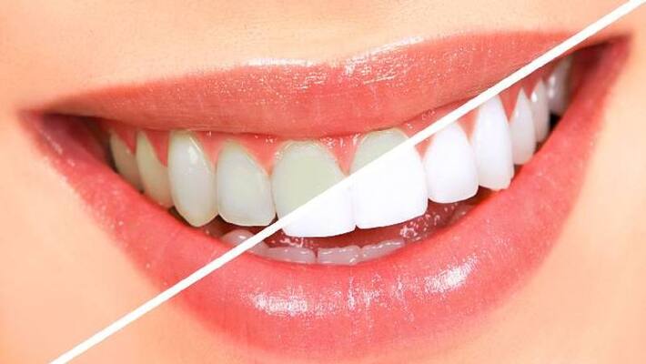 a simple easy tip to whiten teeth a simple easy tip to whiten teeth