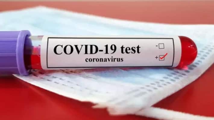 two migrants missing after covid test positive, police starts enquiry