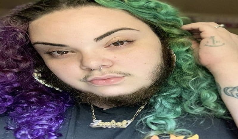 woman with pcos alma torres grow full beard on face