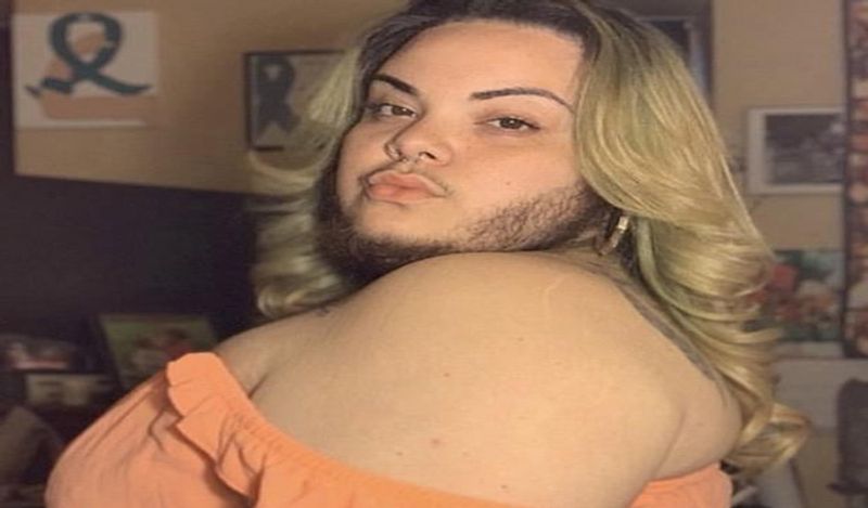 woman with pcos alma torres grow full beard on face