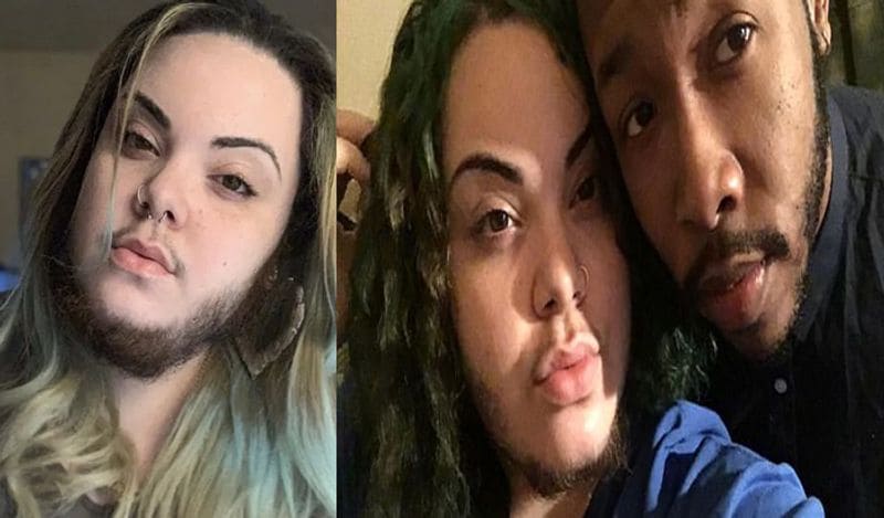 woman with pcos alma torres grow full beard on face