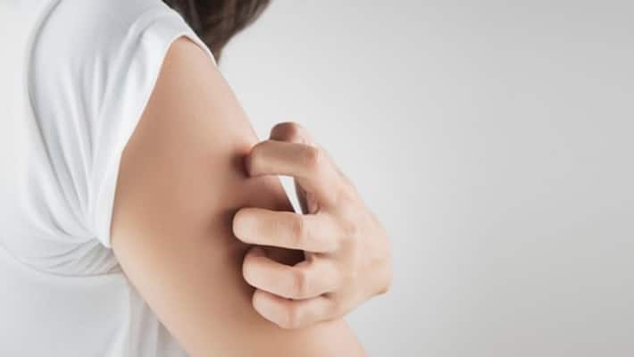 lifestyle changes may decrease skin problems lifestyle changes may decrease skin problems