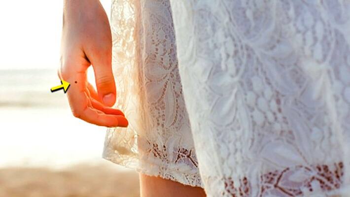 People who have mole on their fingers, they are fortunate, know such special things about it KPI People who have mole on their fingers, they are fortunate, know such special things about it KPI