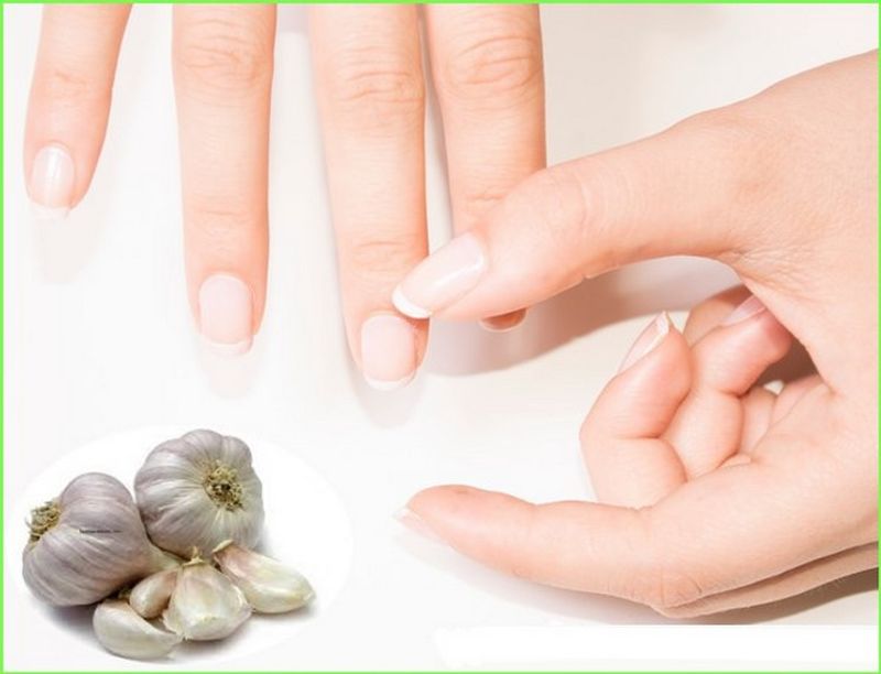 Brittle nails? Try these 4 ways to get healthier nails in no time-dnm