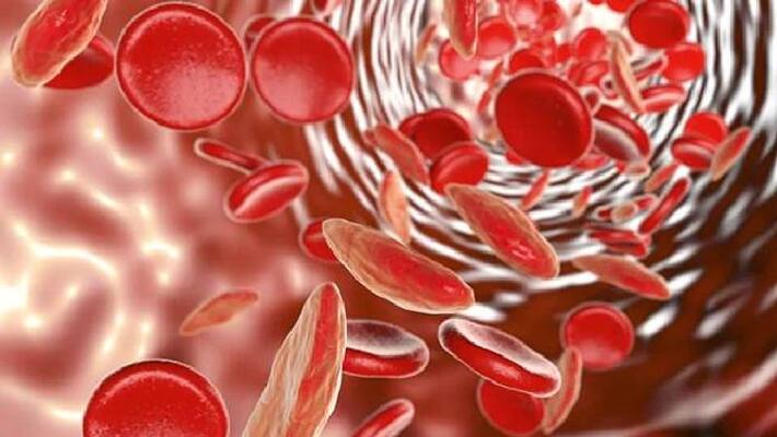 Signs And Symptoms of Iron Deficiency Signs And Symptoms of Iron Deficiency