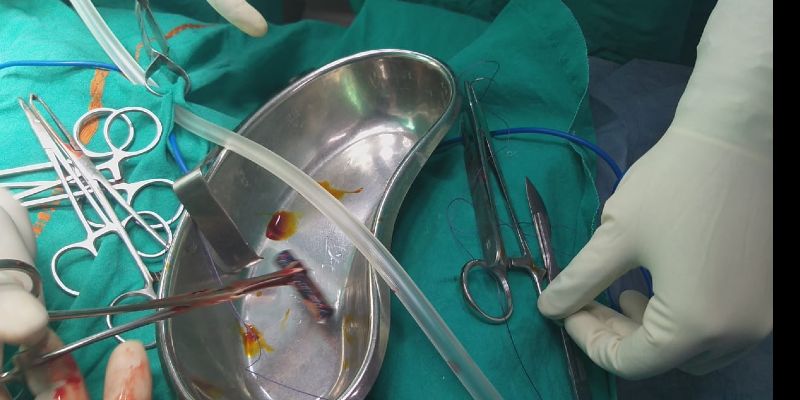 Pencil battery found inside stomach of 3-year-old; doctors perform incision to save life-dbr
