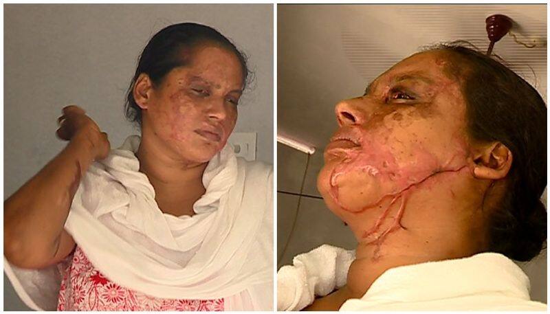 accused of threatening acid attack victim thiruvananthapuram