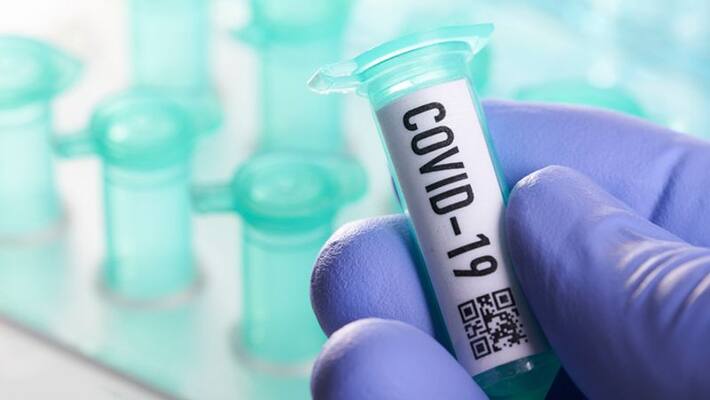 Coronavirus positive cases in Telanagana cross one lakh 17 thousand Coronavirus positive cases in Telanagana cross one lakh 17 thousand