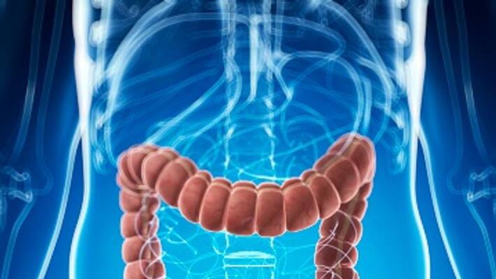 Health tips- need to know about the Causes of Colon Cancer Health tips- need to know about the Causes of Colon Cancer