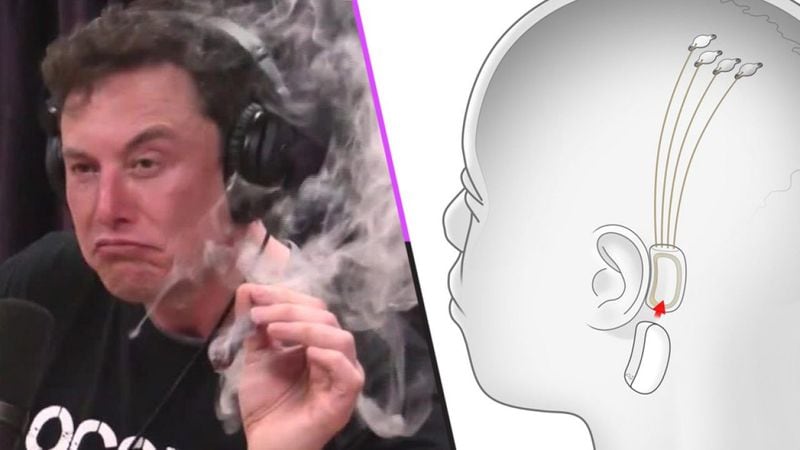 Elon Musk trots out pigs in demo of Neuralink brain implants