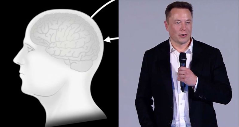Elon Musk trots out pigs in demo of Neuralink brain implants