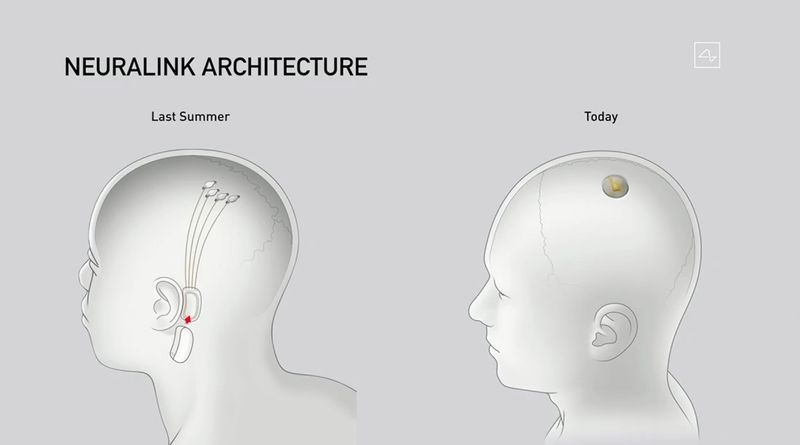 Elon Musk trots out pigs in demo of Neuralink brain implants