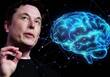 Neuralink 1st patient press mouse button after successfully implanted chip says Elon Musk ckm