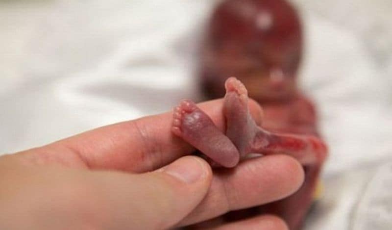 heartbreaking photos of 5 month old fetus killed in the womb american doctors throw it in the trash when it is aborted kph