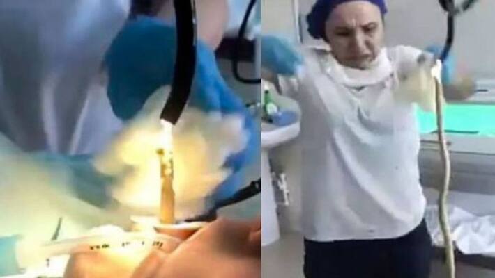 Hair raising video claims to show a 4 feet long snake pulled out of a woman mouth in Russia Gone viral BSS Hair raising video claims to show a 4 feet long snake pulled out of a woman mouth in Russia Gone viral BSS