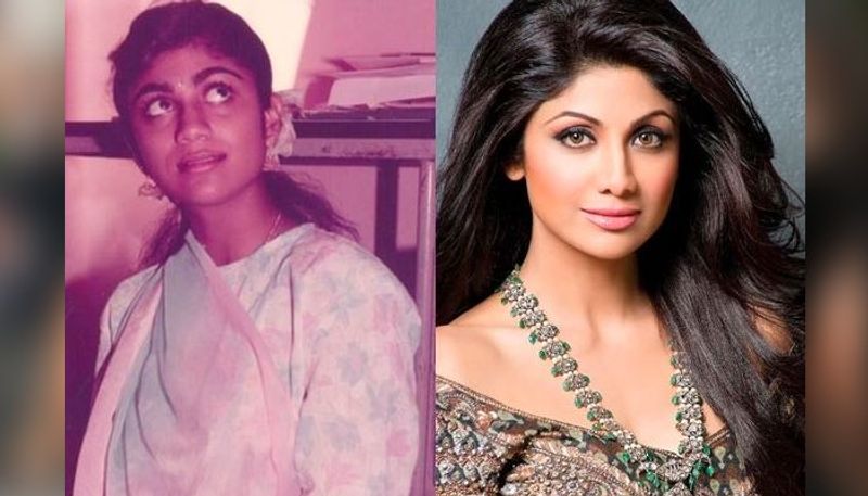 Bollywood actresses who went under multiple skin lightening treatment to make a mark ADB