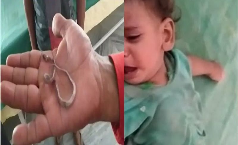 एक बच्चे ने मुंह में सांप के बच्चे को चबा लिया। जब बच्चे के परिजनों ने मासूम को मुंह चलते हुए देखा तो उन्हें कुछ संदेह हुआ। नजदीक से जाकर देखा तो मासूम के मुंह में सांप की पूंछ दिखाई दी।