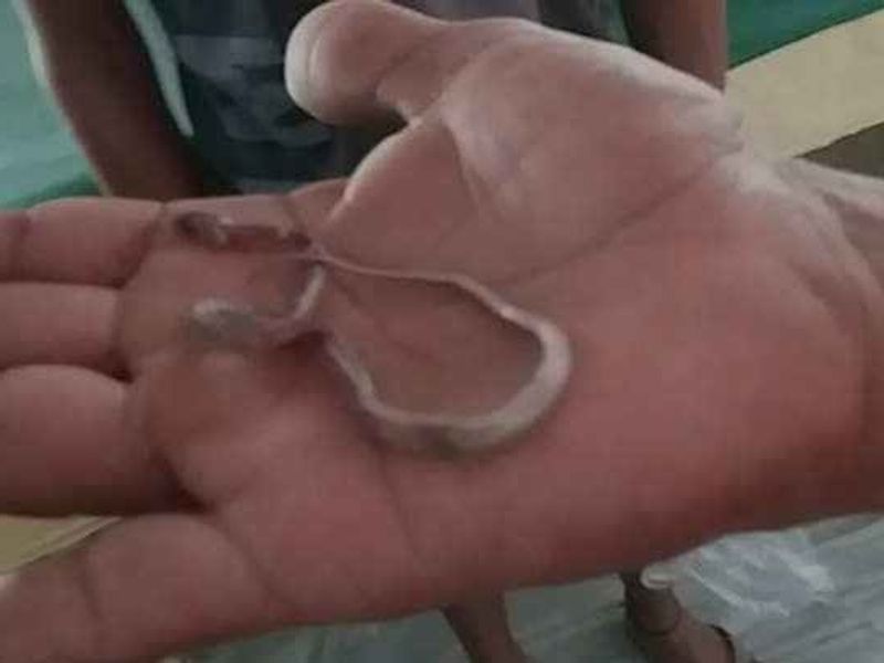 बच्चे के मुंह में 6 इंच लंबा सांप था, जिसे वह चबा रहा था। इसके बाद आनन-फानन में उसे जिला अस्पताल लाया गया। यहां इमरजेंसी वार्ड में बच्चे को भर्ती किया गया है। डॉक्टरों के परीक्षण में बच्चे को खतरे से बाहर पाया गया।
