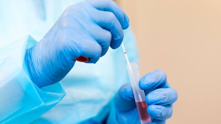 Covid 19: thiruvananthapuram surpass 500 cases Covid 19: thiruvananthapuram surpass 500 cases