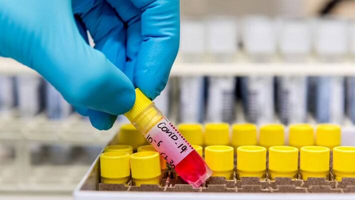 8846 new corona cases reported in andhra pradesh 8846 new corona cases reported in andhra pradesh