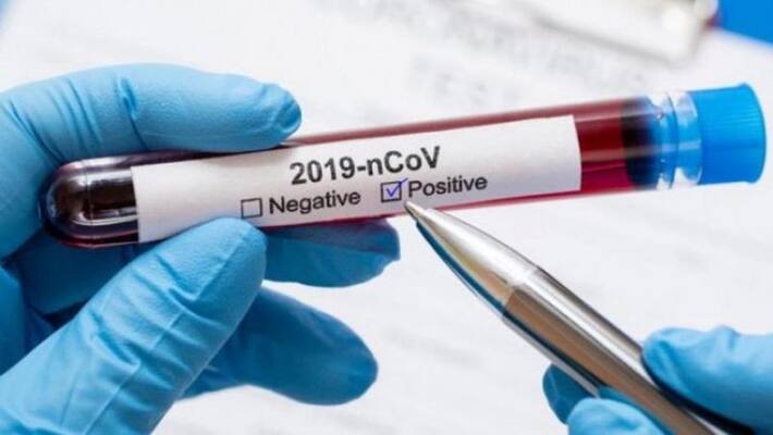 Man commits suicide after tested corona positive in Nadia BTG Man commits suicide after tested corona positive in Nadia BTG