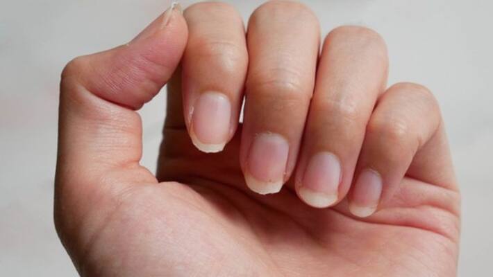 know the symptoms of calcium deficiency know the symptoms of calcium deficiency