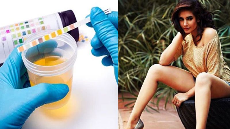 ड्रग टेस्ट के दौरान यूरिन में पानी मिलाने का आरोप
डेक्कन क्रॉनिकल में पब्लिश एक रिपोर्ट के मुताबिक, इस मामले में ड्रग टेस्ट के लिए रागिनी को बेंगलुरु के मल्लेस्वरम में केसी जनरल अस्पताल ले जाया गया। डॉक्टरों ने बताया कि रागिनी ने जो सैंपल दिया था उससे छेड़छाड़ की गई थी। डॉक्टर्स ने इस बात की जानकारी सीसीबी अधिकारी को दे दी है।
