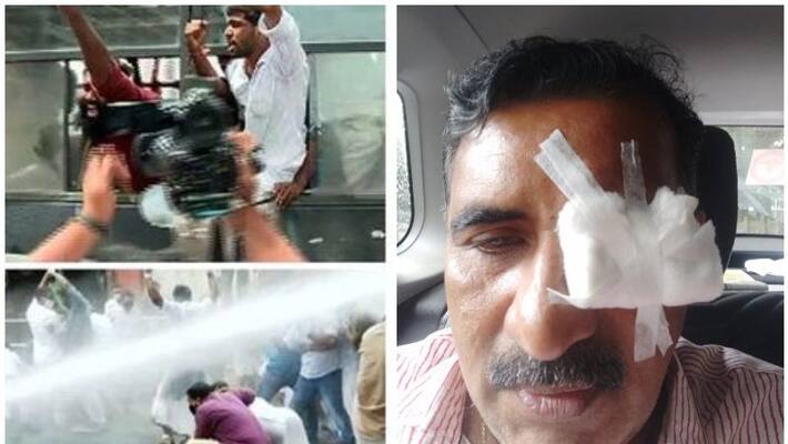 BJP leader B Gopalakrishnan injured during protest demanding resignation of K T Jaleel BJP leader B Gopalakrishnan injured during protest demanding resignation of K T Jaleel
