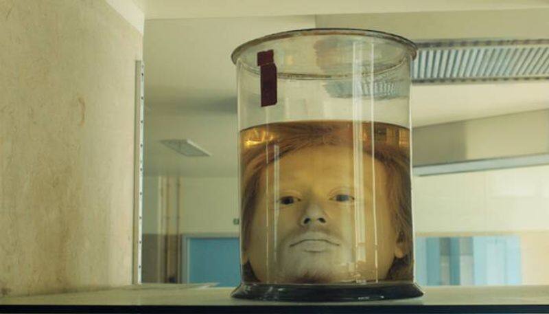 Why the University of Lisbon preserved head of a serial killer