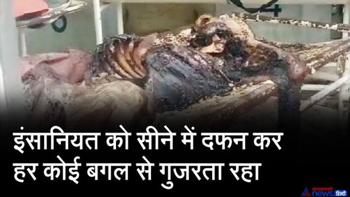 madhya pradesh indore my hospital Negligence Case dead body kept on stretcher in mortuary room kpr madhya pradesh indore my hospital Negligence Case dead body kept on stretcher in mortuary room kpr