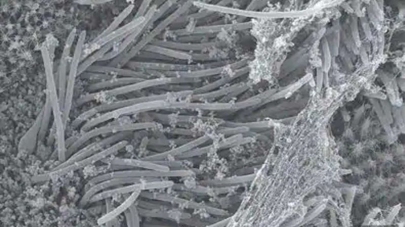 SARS CoV 2 Photo published by scientists photo story