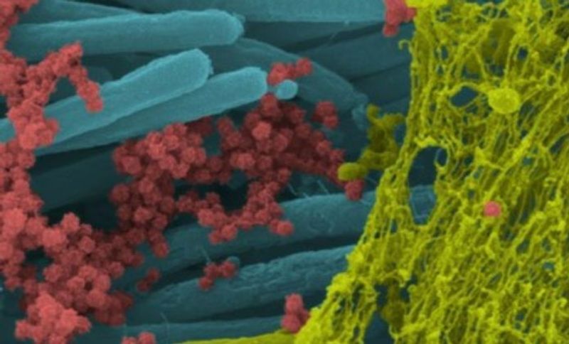 SARS CoV 2 Photo published by scientists photo story
