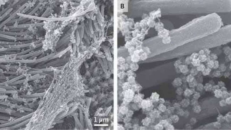 SARS CoV 2 Photo published by scientists photo story
