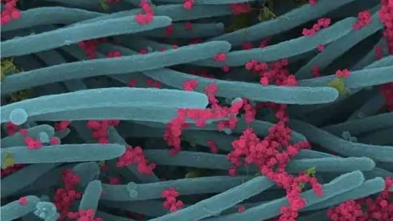 SARS CoV 2 Photo published by scientists photo story