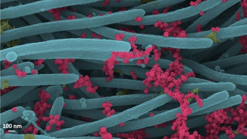 SARS CoV 2 Photo published by scientists photo story