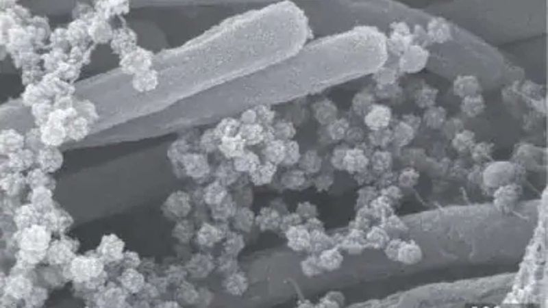 SARS CoV 2 Photo published by scientists photo story