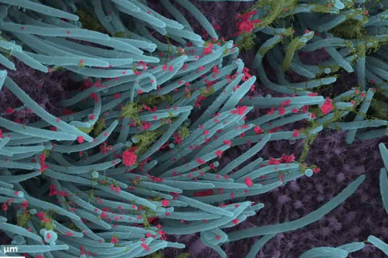 SARS CoV 2 Photo published by scientists photo story