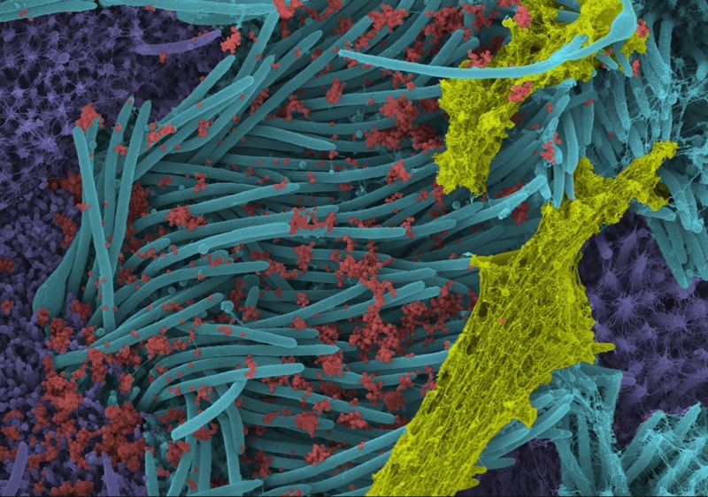 SARS CoV 2 Photo published by scientists photo story