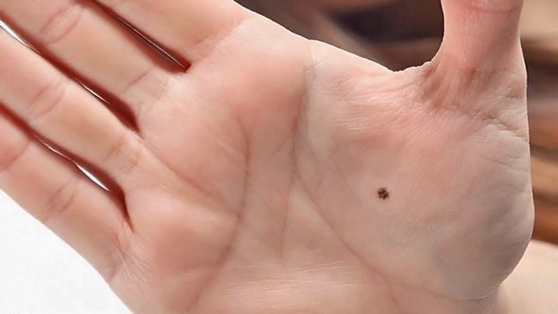 Is there an 'H' mark on the palms? Learn the secret of it!