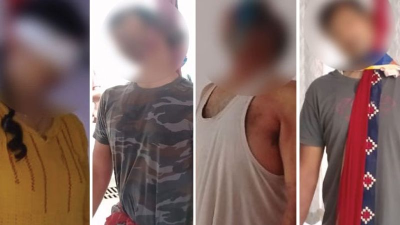 पिता के अलग-बगल लटके थे दोनों बेटे
पुलिस को लोगों ने बताया कि भरत सोनी के घर का दरवाजा सुबह से ही बंद था। दो तीन घंटे होने के बाद जब कोई हलचल नहीं हुई तो पड़ोसियों ने उनको आवाज दी, लेकिन कोई हलचल नहीं हुई। फिर लोगों को अनहोनि की अशंका हुई तो उन्होंने खिड़की से झांककर देख तो पूरा परिवार फंदे पर लटक रहा था।