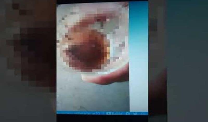 लोकल मीडिया के अनुसार अभी तक पुलिस ने किसी भी तरह का मामला दर्ज नहीं किया है। वो शख्स के मेडिकल एग्जामिनेशन के खत्म होने का इन्तजार कर रही है। इसके बाद ही पुलिस कोई फैसला ले पाएगी। 