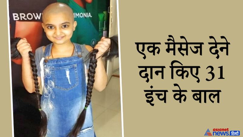 सूरत की रहने वाली देवना के मां-बाप बताते हैं कि इससे पहले वो अपने बालों को हाथ तक नहीं लगाने देती थी। लेकिन कैंसर पीड़ितों के लिए उसने हंसते हुए बाल दान कर दिए।