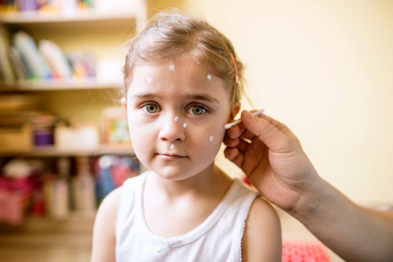 Things Your Patients Need to Know About Hand, Foot, and Mouth Disease dpl